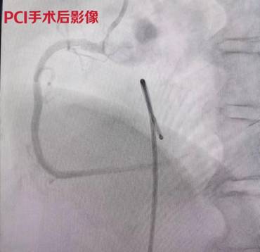 f60a1a2dce0582da67da3f4395f24fa