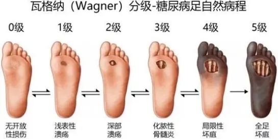1f2a9ed1c7fe985a37f9c2ec92a96bf7-sz_157061.webp